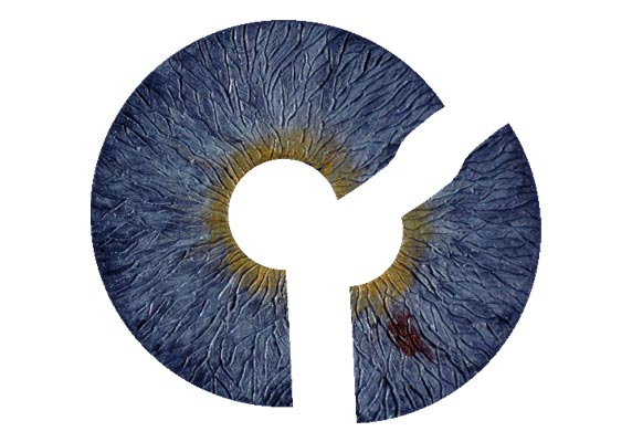 Artificial Iris