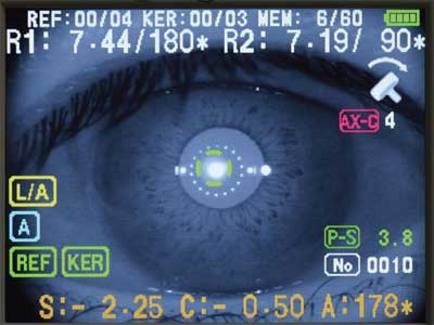 AUTOMATIC AXIS COMPENSATION AND