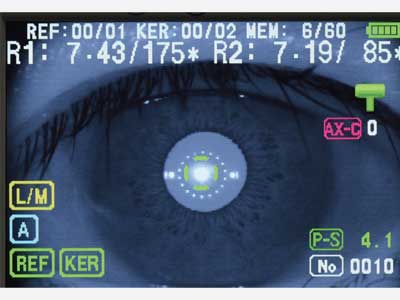 AUTOMATIC AXIS COMPENSATION AND