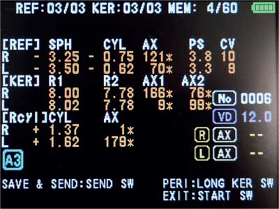 AUTOMATIC AXIS COMPENSATION AND