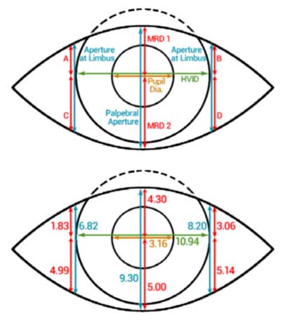 Volk eye Check